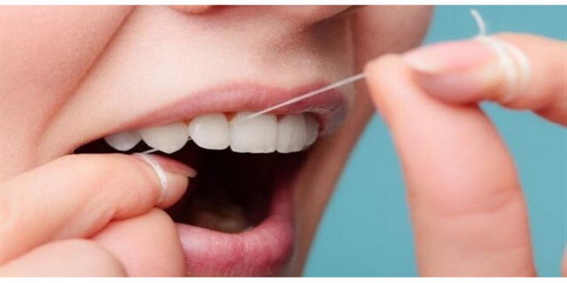 آموزش نخ دندان کشیدن چگونه است؟